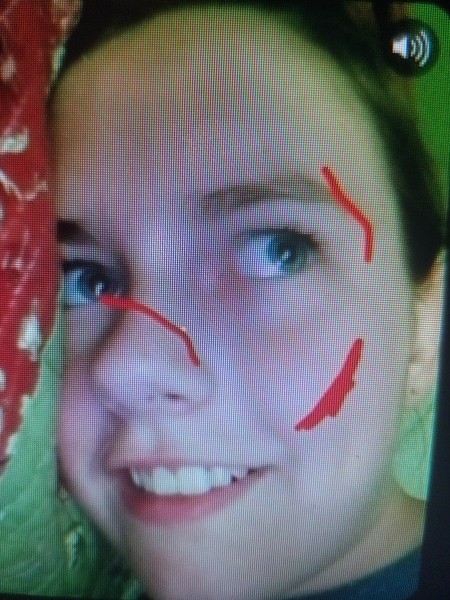 A picture of a girl with red lines on her face.